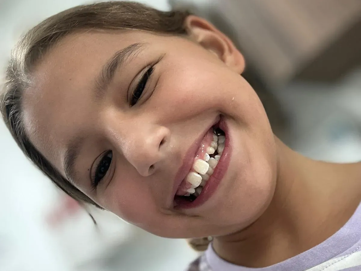 Plantation Dentist Happy Kid Smile